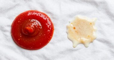 protein stains differ significantly